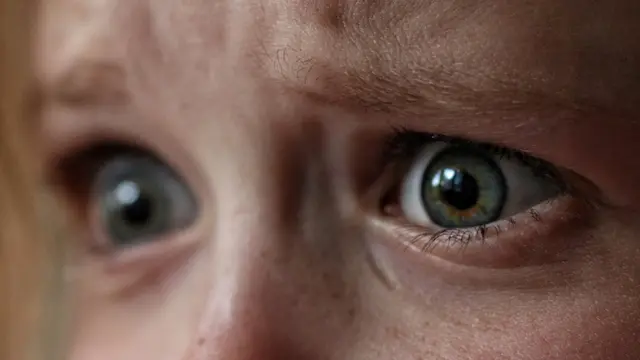 Ojos