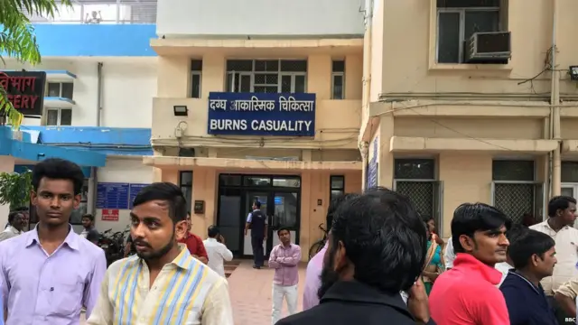 सफ़दरजंग का बर्न वॉर्ड