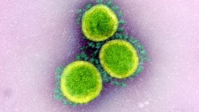ภาพขยายอนุภาคไวรัส SARS-CoV-2 จากกล้องจุลทรรศน์อิเล็กตรอน