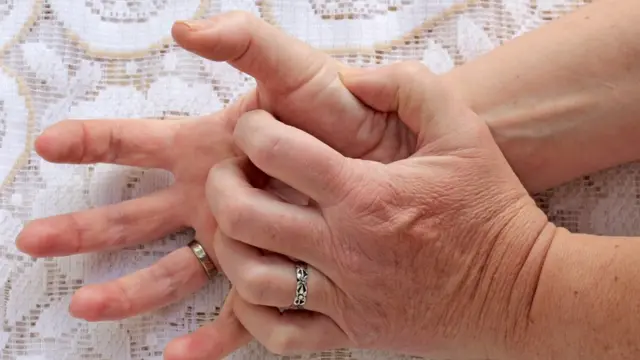 एपिलेप्सी आकडीः फीट आल्यानंतर कांदा-चप्पल हुंगवणं योग्य की अयोग्य?