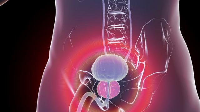 Ilustração próstata