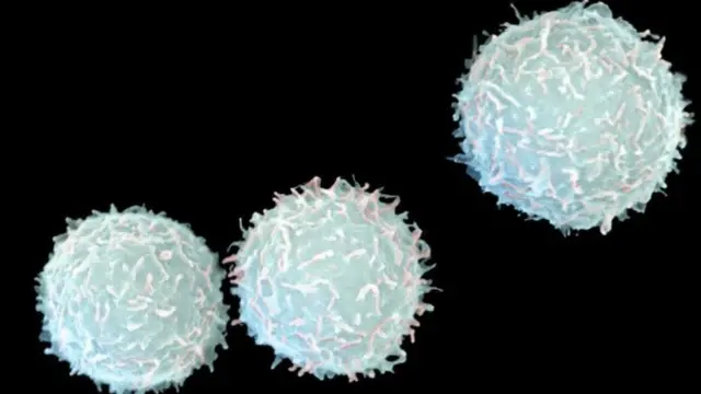 મ્યુકોરમાઇકોસિસના દરદીને શરીરમાં સખત દુખાવો થાય છે અને 20-30 ટકા દરદી પોતાની દૃષ્ટિ ગુમાવે છે.