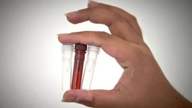 কোভিড-১৯র টিকা বানানোর জন্য প্রায় শতাধিক প্রকল্প চলছে বিভিন্ন দেশে