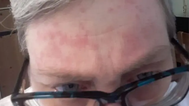 लिझ नाईट