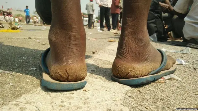 ખેડૂતના પગમાં પડેલા ચીરાનો ફોટોગ્રાફ