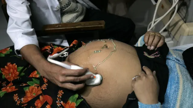 गर्भवती महिला