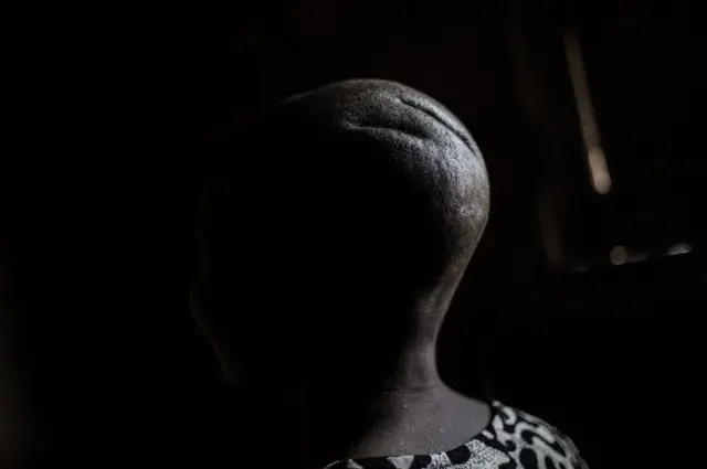 Haweeney si xun loo dhaawacay