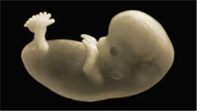 పిండానికి జీవించే హక్కుందా?