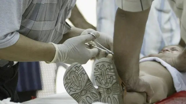 Ibe ugwu ụmụnwoke