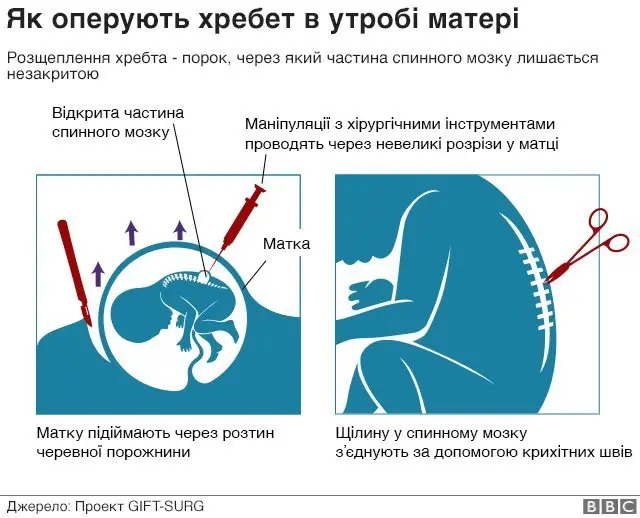 схема операції