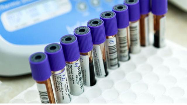 examesmajor sport betsangue