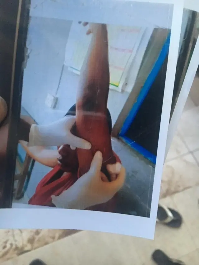 Di late prophetess dey receive treatment afta her husband allegedly stab her with knife