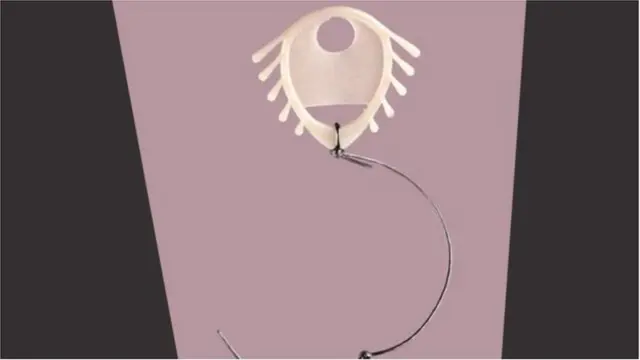 గర్భనిరోధకాలు