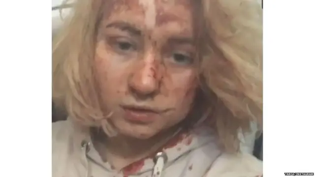 यूक्रेन के सोशल मीडिया पर कुछ ही घंटों में इंस्टाग्राम पर डाला तानिया का वीडियो वायरल हो गया.