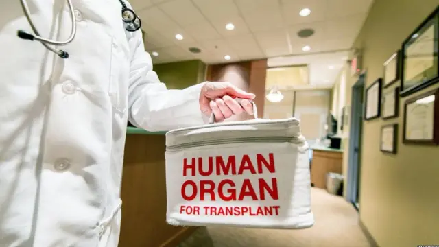 organ donation
