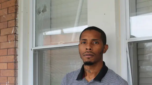 Devrone McKnight masih memiliki serpihan peluru yang tertanam di pipi dan lehernya