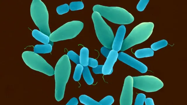 Clostridium perfringens связывают с возникновением заболеваний желудочно-кишечного тракта