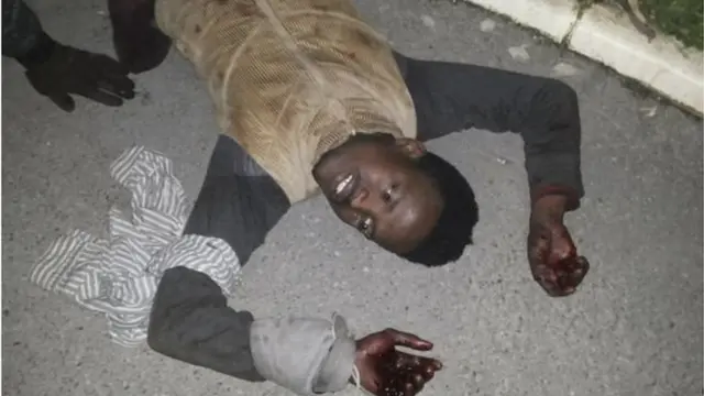 Qaar ka mid ah Tahriibayaasha ayaa gacmaha ka dhaawacmay ka dib markii xeyndaab silig ah ay qabsadeen