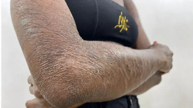 le coude de Onyinye Maduka