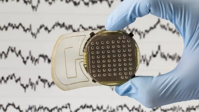 Sensors read brain activity