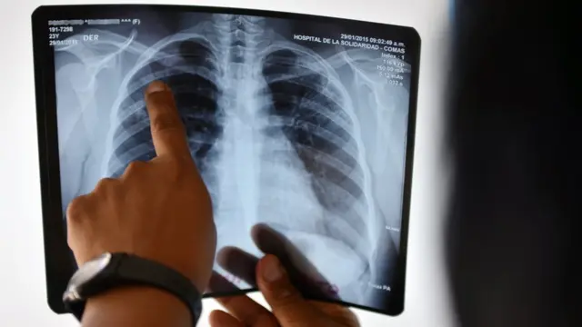 Врач рассматривает рентген. Лима, Перу, 2015 год.