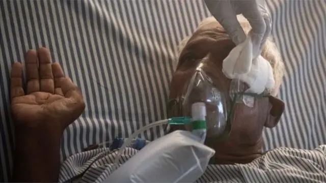 મ્યુકરમાયકોસિસ સાઇનસને અસર કરે છે અને તેના કારણે આંખ પણ કાઢવી પડી શકે છે