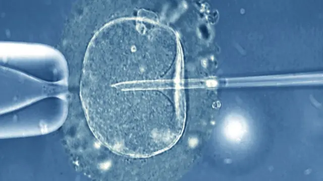 Fertilização in vitro