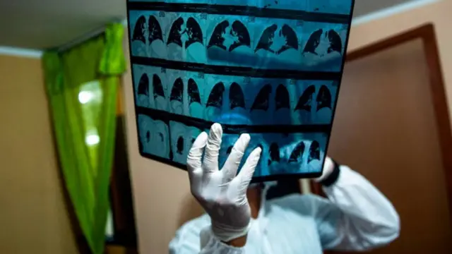 Проучавање људи који показују необичне нивое отпора или подложности на Ковид-19 може довести до нових терапија (Ernesto Benavides/Getty Images)