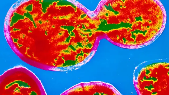 Células de levadura.