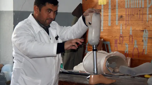 خدمات رایگان کارخانه اورتز و پروتز شهر دوشنبه