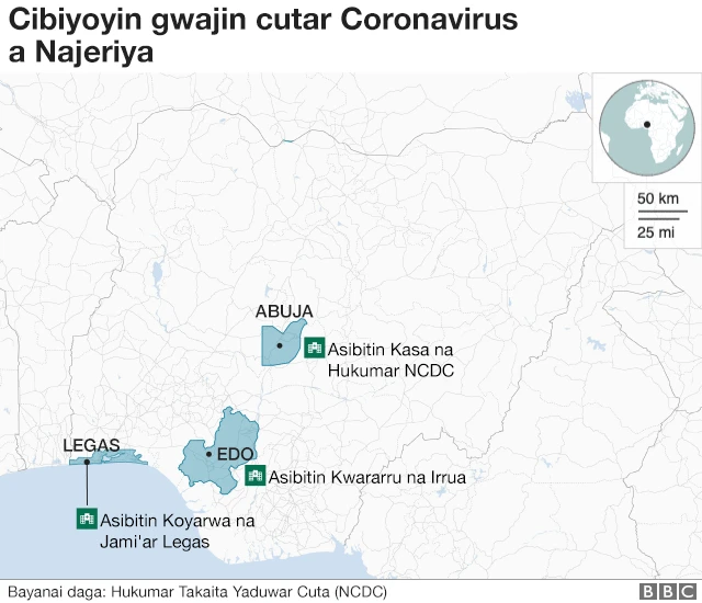 cibiyoyin gwajin coron