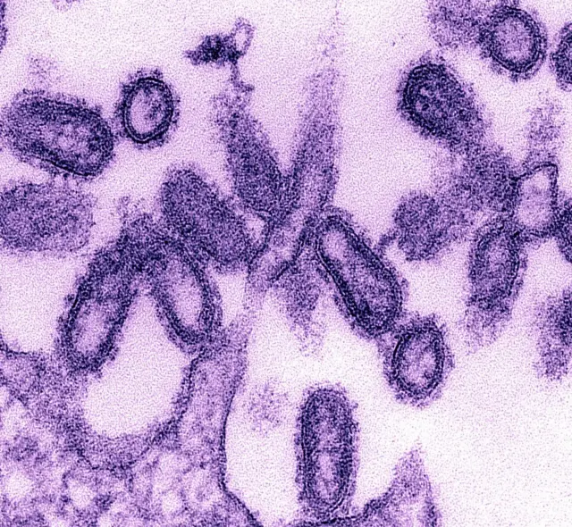 स्पैनिश फ्लू