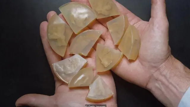 आइंस्टीन के दिमाग के टुकड़े और आंखें आज भी रखी हुई हैं.