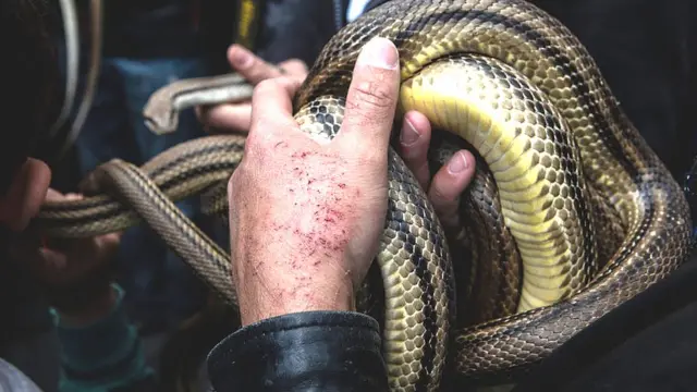 பாம்பு கடி