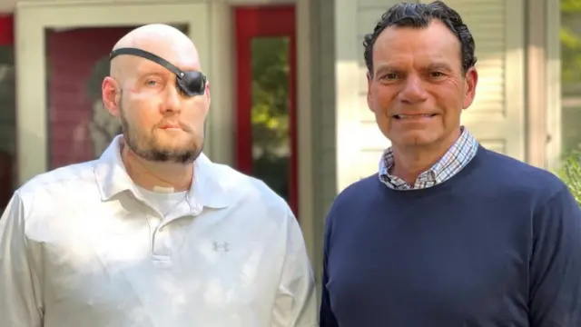 Aaron James of Hot Springs, Arkansas, poses with Dr Eduardo D. Rodriguez after he underwent surgery for the world’s first whole eye transplant as part of a partial face transplant at NYU Langone