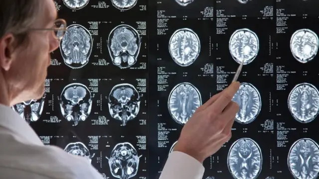 Médico delante de una rediografía