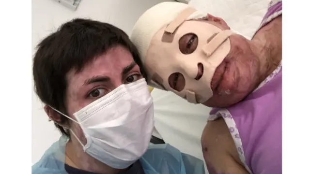 Noelia visita a otro quemado en la Posta Central