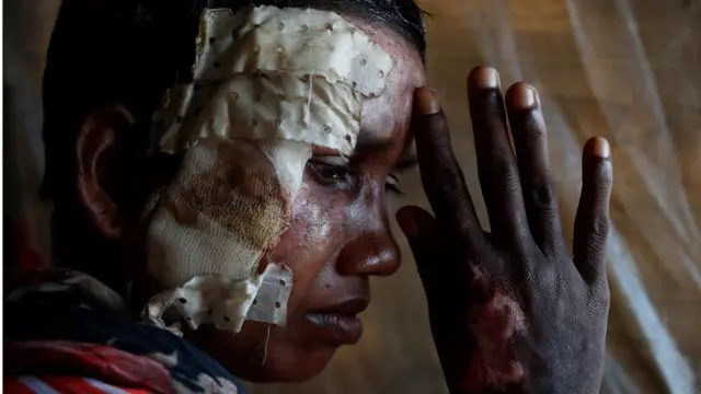 Rohingya lady Momtaz Begum