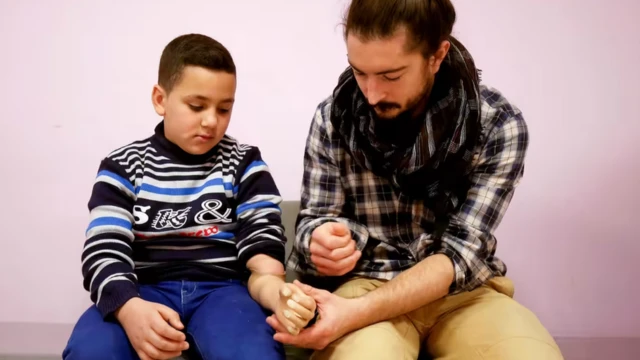 مريض شاب في مستشفى الجراحة الترميمية لأطباء بلا حدود في عمان ، الأردن