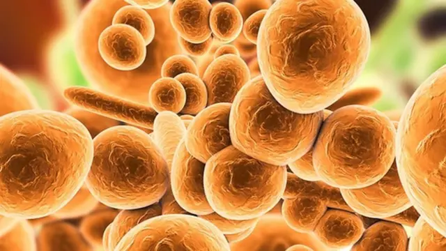 ميكروب كانديدا أوريس