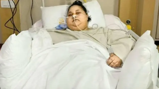 Elle souffrait d'éléphantiasis, une pathologie qui provoque un gonflement des membres et d'autres parties du corps.