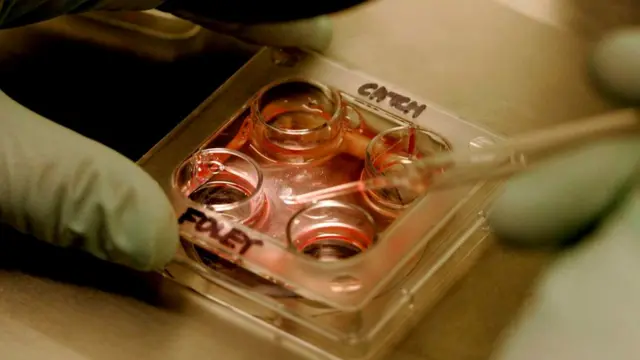 Для лечения некоторых заболеваний использование стволовых клеток открывает серьезные перспективы, но во многих других случаях польза этого еще совершенно не доказана