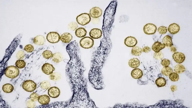 કોરોના વાઇરસ