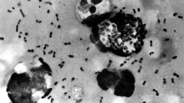 يمكن أن تدخل البكتيريا أيضا مجرى الدم وتسبب ما يعرف باسم "تسمم الدم"