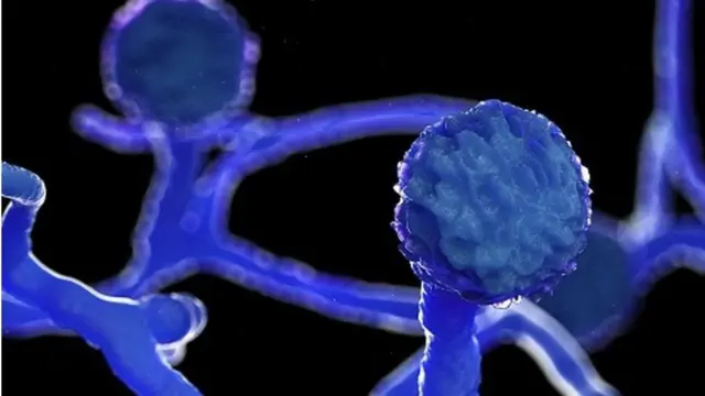 ભારત સહિત કેટલાક અન્ય દેશોમાં પણ મ્યુકરમાયકોસિસના કેસ સામે આવ્યા છે, જ્યાં ડાયાબિટીસના દર્દીઓની સંખ્યા વધુ છે