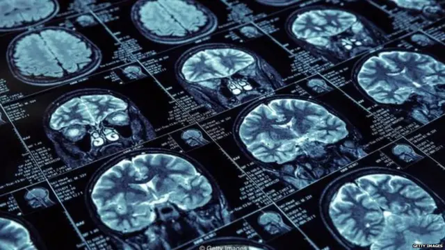 ਨੀਂਦ, ਸੋਣਾ, ਵਿਦਿਆਰਥੀ, ਪੜ੍ਹਾਈ , ਲੈਬ