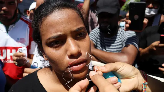 Una migrante se cose los labios en protesta en Tapachula, México, 15 de febrero 2022