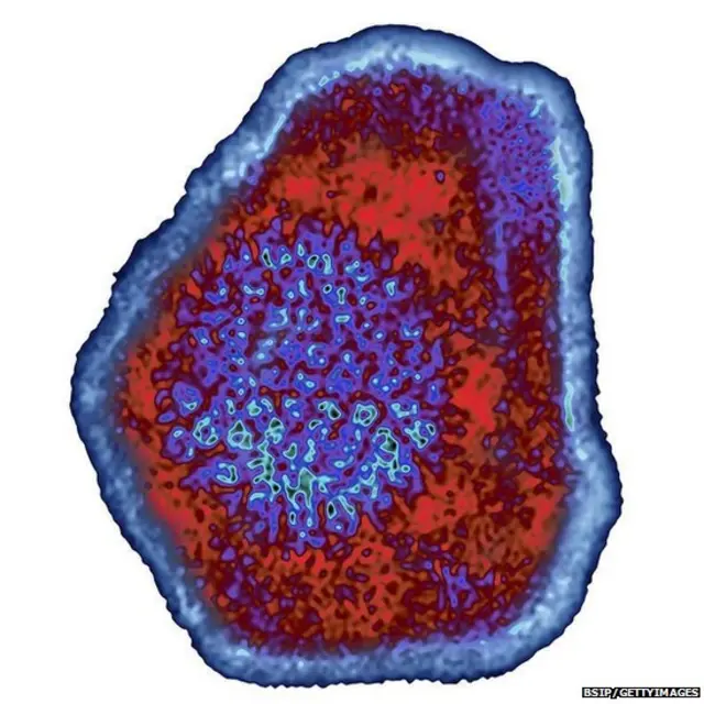 मंकी बी व्हायरस