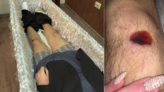 Даже эти травмы, как уверены родственники, доказывают, что Сарычева били непосредственно перед смертью