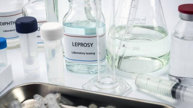 Vidros e equipamentossport recife x tombenselaboratório, um deles com o rótulo indicando o nome da hanseníasesport recife x tombenseinglês